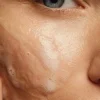 Deep Cleansing Gel 150ml